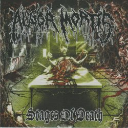 画像1: ALGOR MORTIS - Stages of Death [CD]