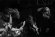 画像3: BLAZING TOMB - Singles From The Tomb [EP]